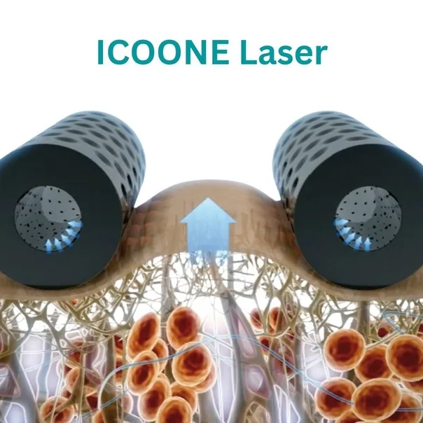 ICOONE — 2